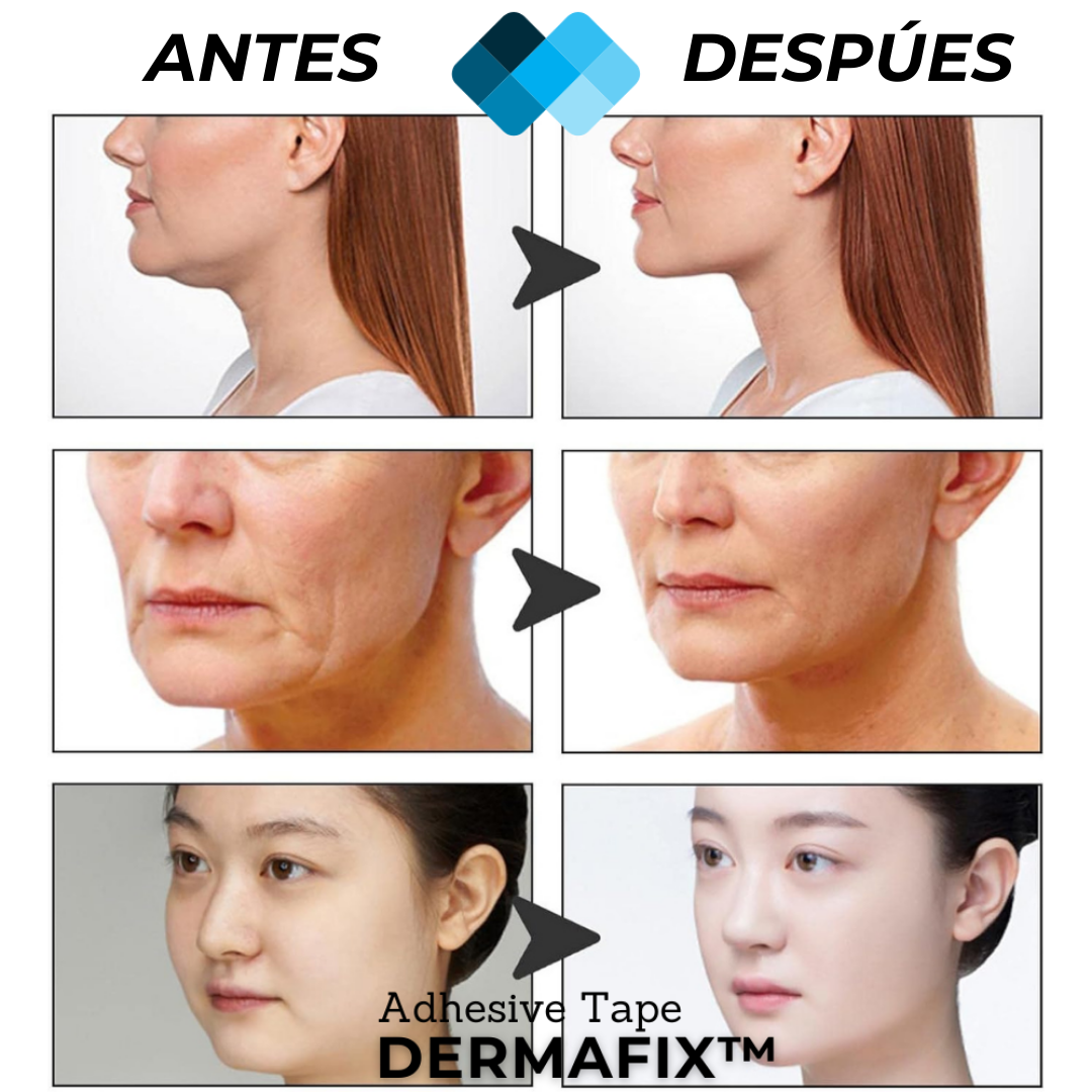 (PACK 100 Unidades) Tiras de Lifting facial efecto Natural "Buena Cara" l BeautySide™